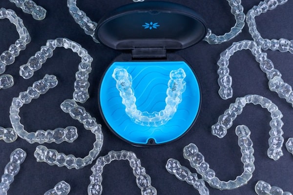 invisalign-lynn-valley-dental-centre