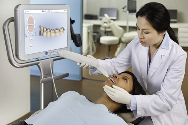 itero-scanner-lynn-valley-dental-centre