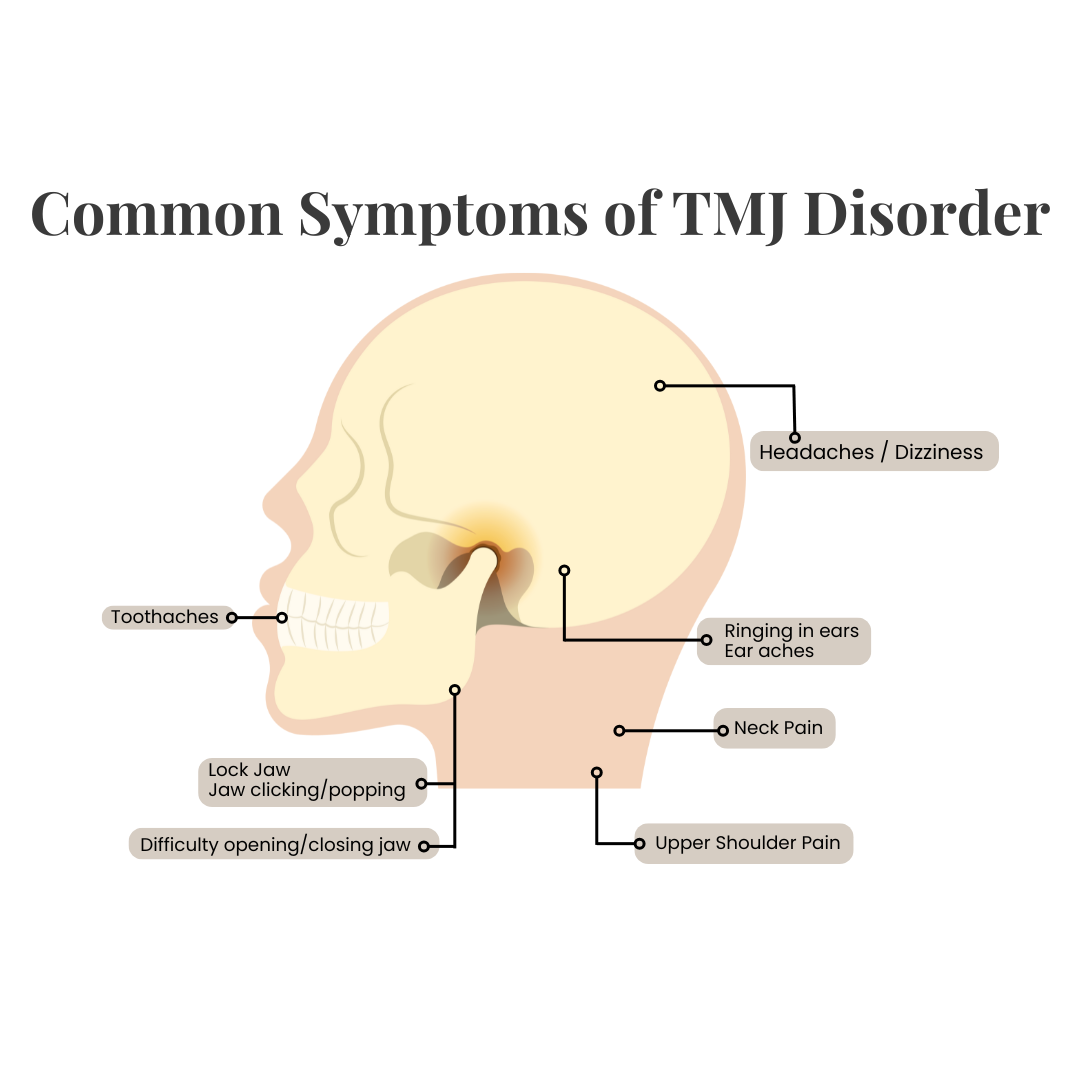 Dentistry on Dundas (ON-0297) - Marketing Support Request #20396 (April newsletter) Common Symptoms of TMJ Disorder